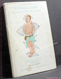image of Acupuncture: The Ancient Chinese Art of Healing