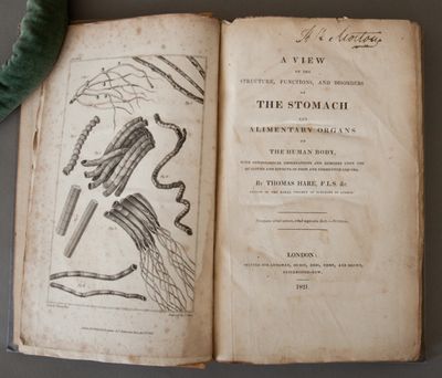 A View Of The Structure, Functions, And Disorders Of The Stomach And Alimentary Organs Of The Human Body, With Physiological Observations And Remarks Upon The Qualities And Effects Of Food And Fermented Liquors