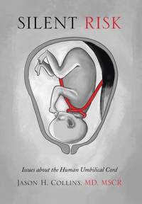 Silent Risk: Issues about the Human Umbilical Cord