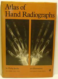 ATLAS OF HAND RADIOGRAPHS.